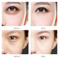 Hydrogel Wrinkle Remover Black Pearl Eye Patches
