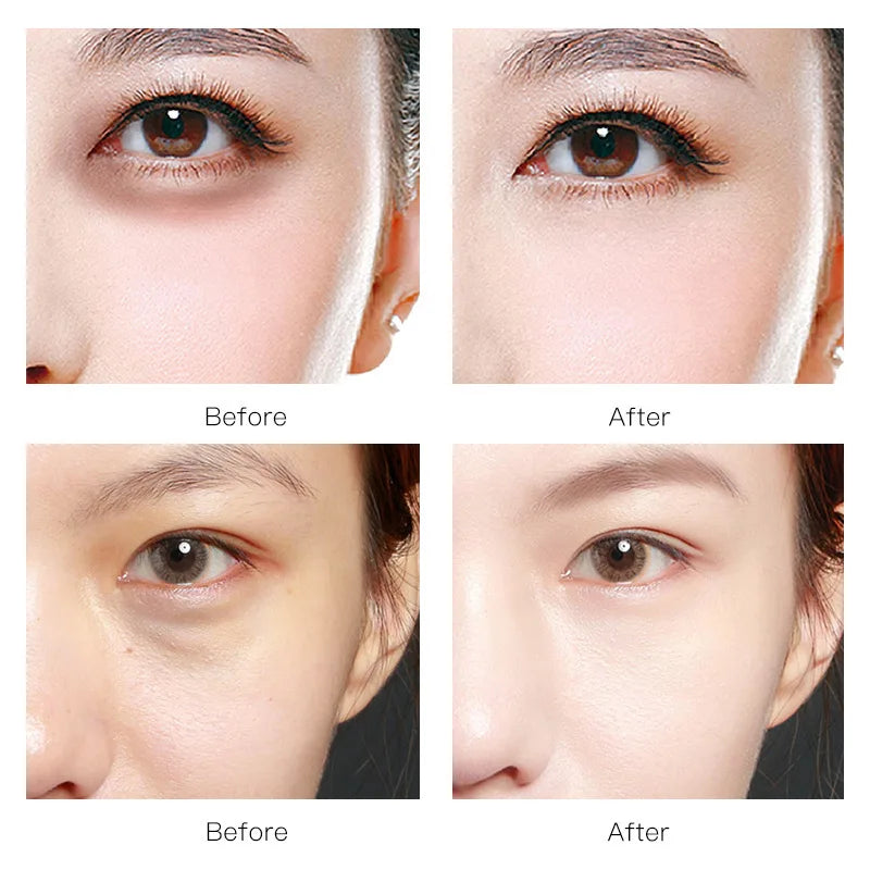 Hydrogel Wrinkle Remover Black Pearl Eye Patches