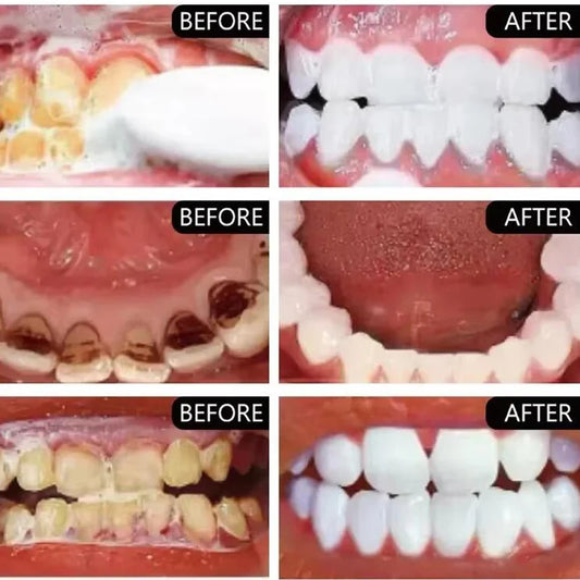 One Minute WhiteTeeth Powder