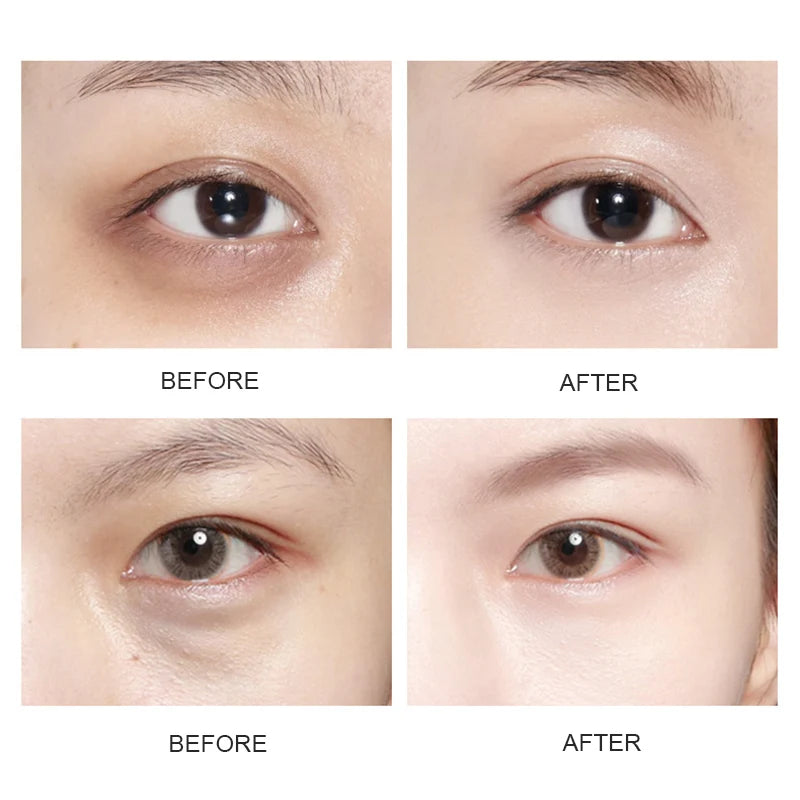 Collagen Gel Dark Circles Remover Eye Patches